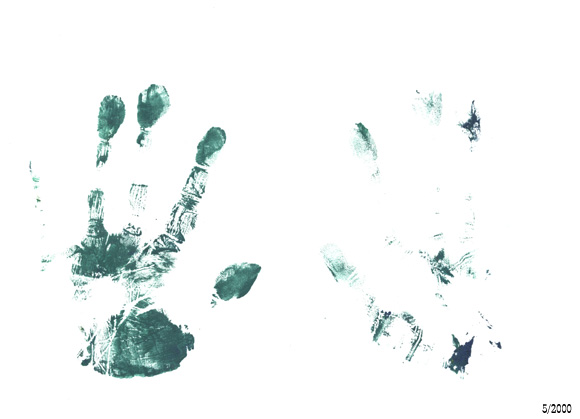 Hand
